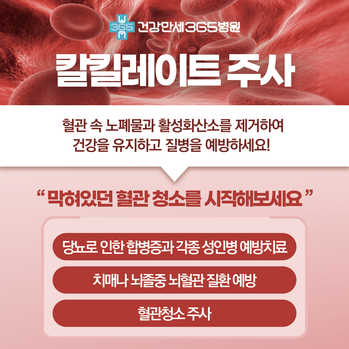 팝업