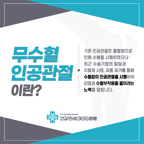 팝업